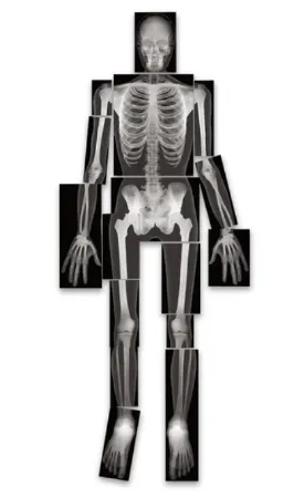 Nasco - Roylco - SB40317 - True-to-Life Human X-Rays Roylco