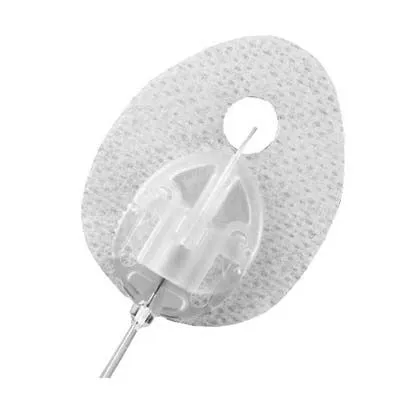 Tandem Diabetes Care - From: 1002827 To: 1002832 - VariSoft Infusion Set, 17 mm Cannula, 43" Tubing, t:lock Connector.